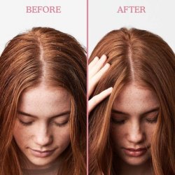 Umberto Giannini Scalp Restore Shampoo Vegan Cruelty Free Reviving Anti-Dandruff Formula with Super Fruit Enzymes 250ml