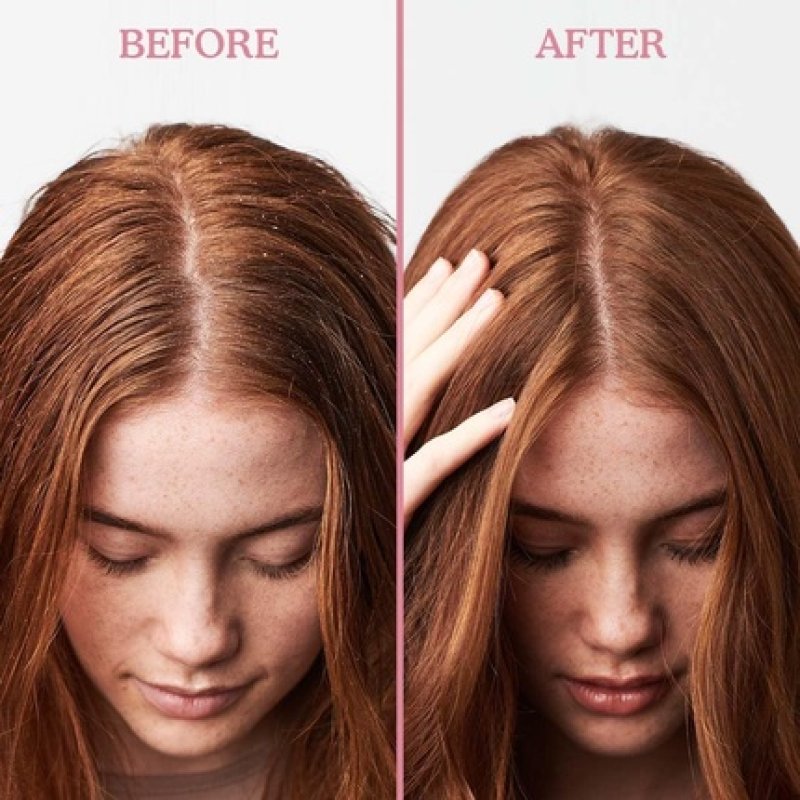 Umberto Giannini Scalp Restore Shampoo Vegan Cruelty Free Reviving Anti-Dandruff Formula with Super Fruit Enzymes 250ml