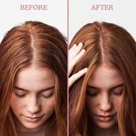 Umberto Giannini Scalp Restore Shampoo Vegan Cruelty Free Reviving Anti-Dandruff Formula with Super Fruit Enzymes 250ml