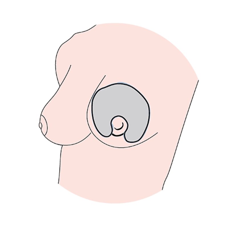 Anteprima Brands Thermal Gel Cushions For Breasts