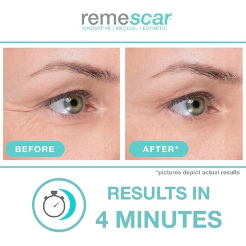 Remescar Crow's Feet Eye Cream Clinically Proven to Reduce Crows Feet Anti-Ageing for Men & Women Filler for Fine Lines