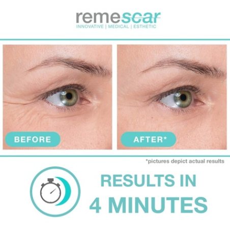 Remescar Crow's Feet Eye Cream Clinically Proven to Reduce Crows Feet Anti-Ageing for Men & Women Filler for Fine Lines