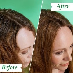 Philip Kingsley Flaky/Itchy Scalp 1000 ml Shampoing Femmes