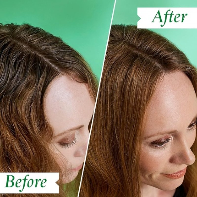 Philip Kingsley Flaky/Itchy Scalp 1000 ml Shampoo Women