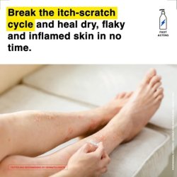 Healpsorin Emollient Balm Eczema Cream for Face Itch Relief