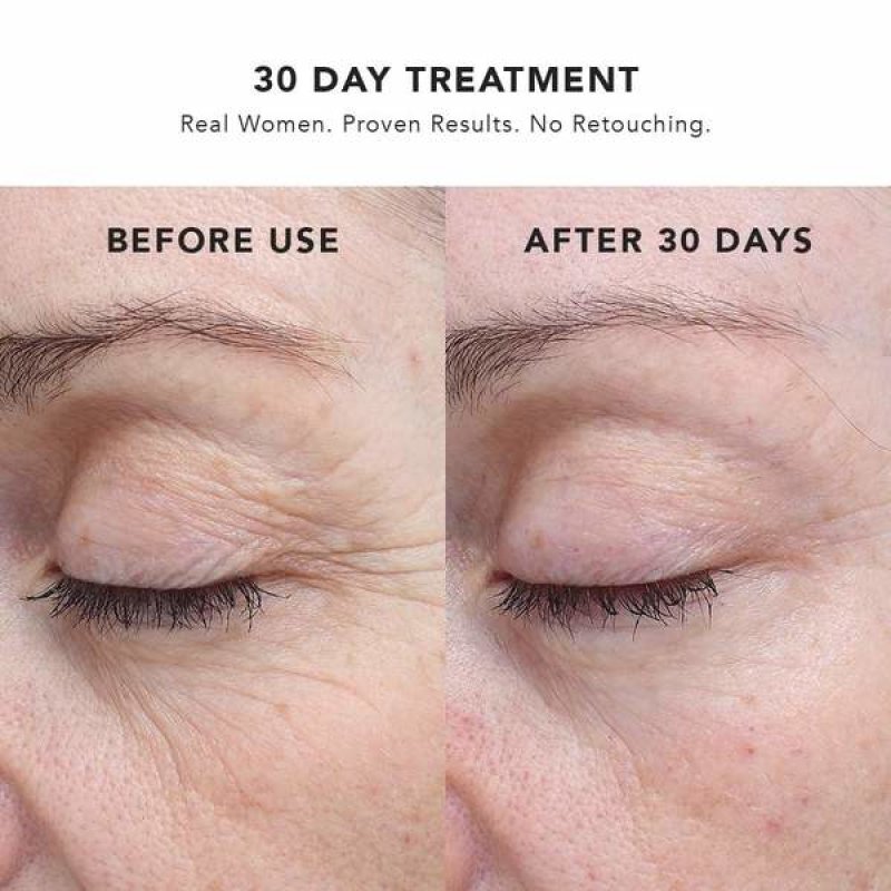 30 Day Treatment