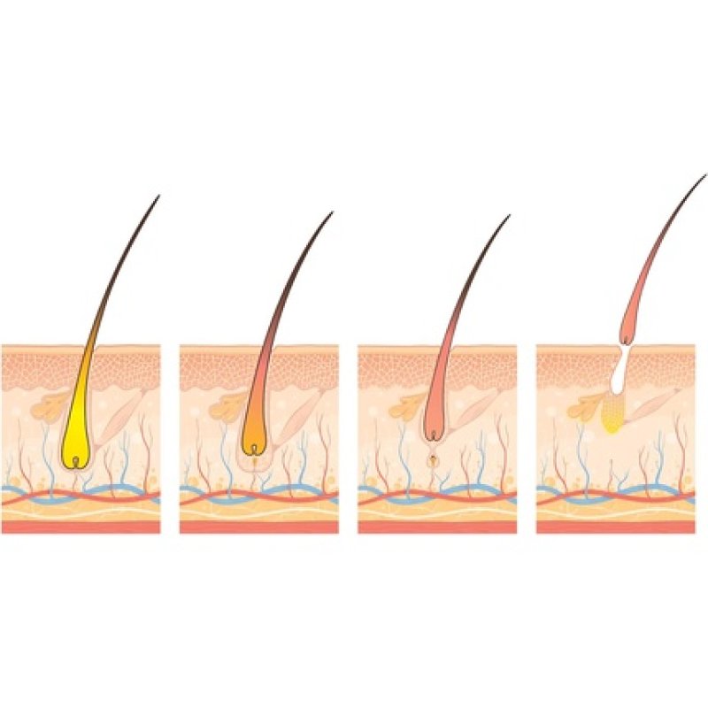 Annurkap Fortifying Energizing Hair Loss Ampoules