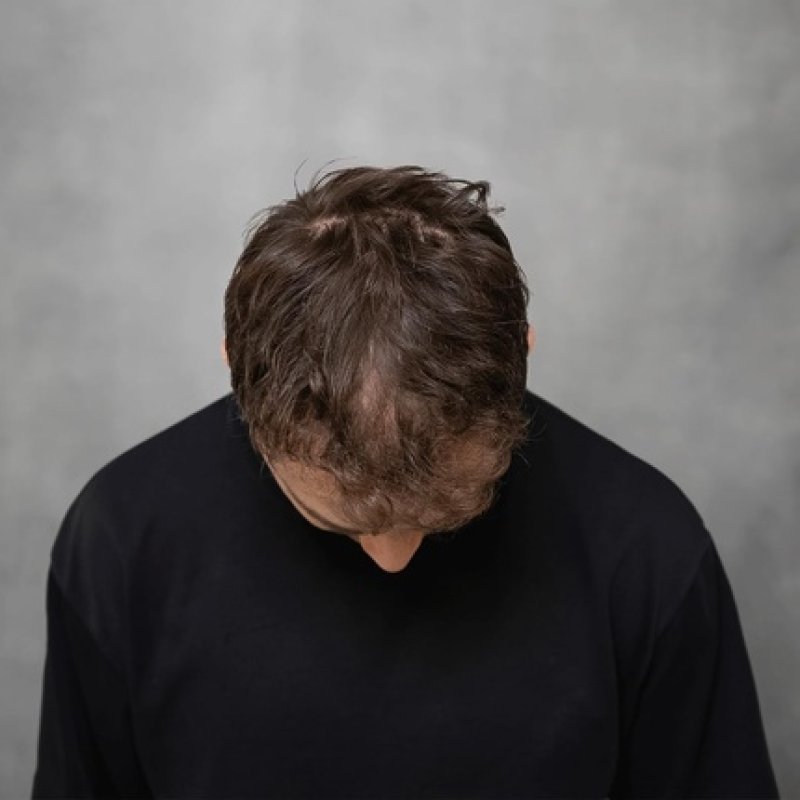 Keratin Thickening Hair Fibers Dark Brown 25g