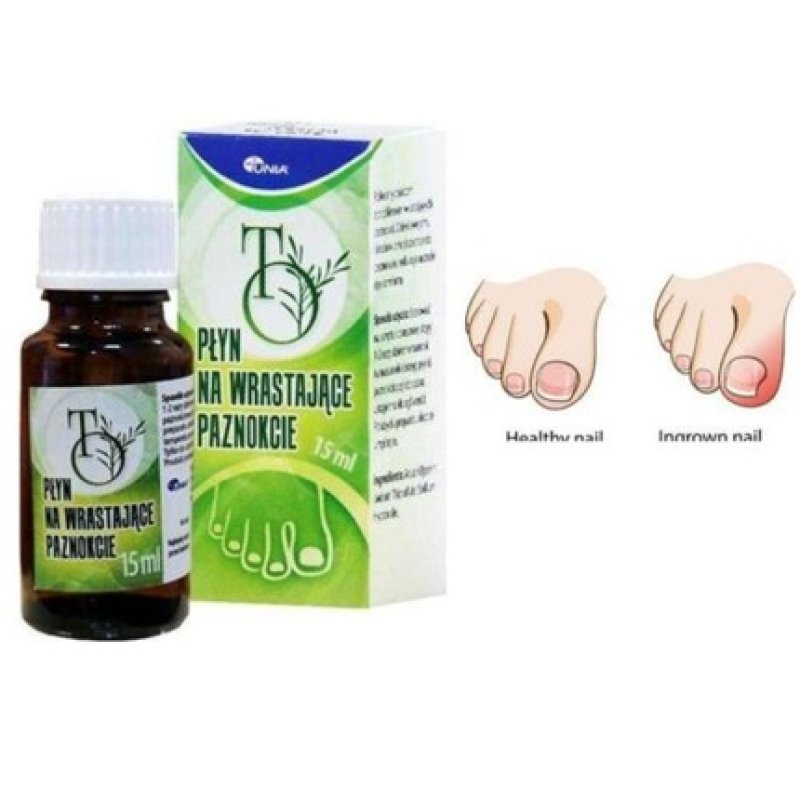 To Nail Liquid for Ingrown Toenails 15ml