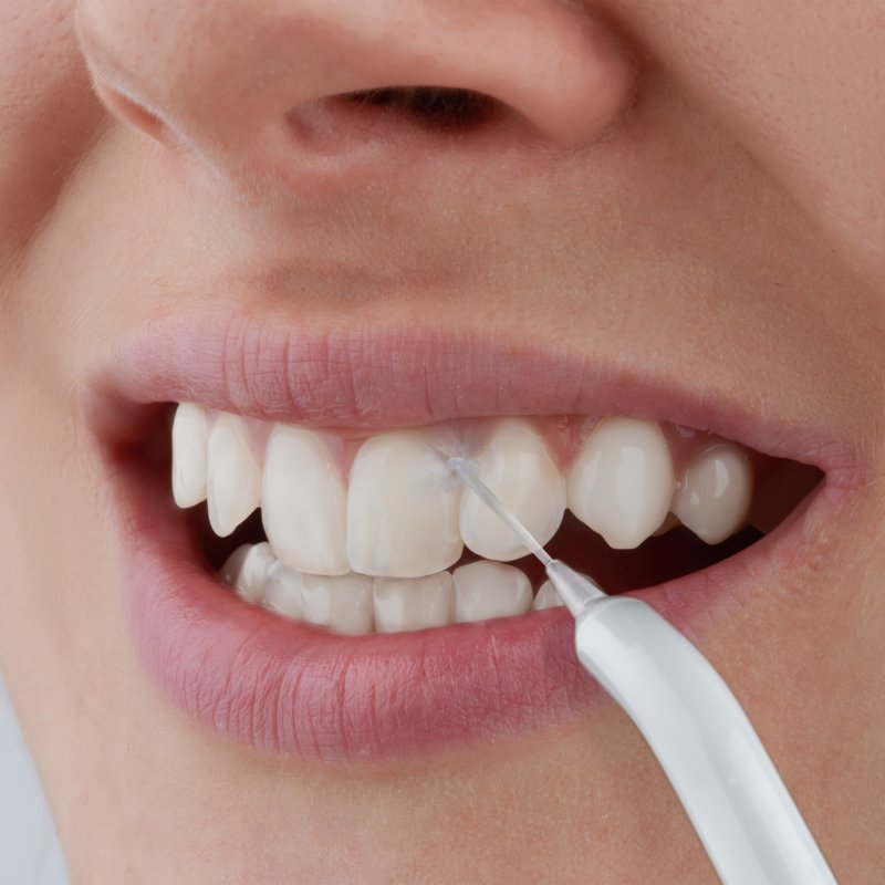 Sencor SOI 2200SL oral irrigator 0.6 L