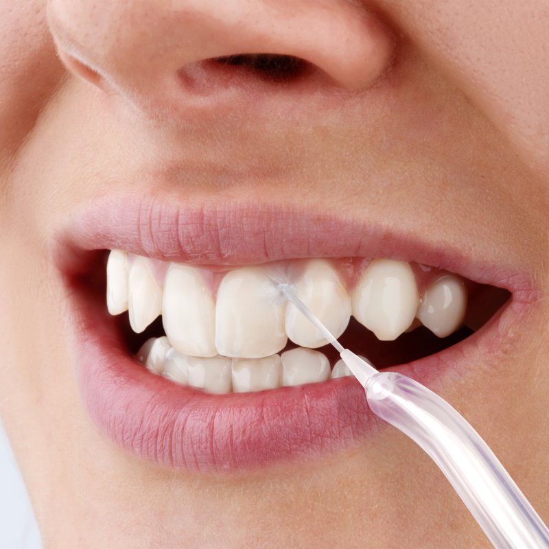 Sencor SOI 3312WH oral irrigator 0.6 L