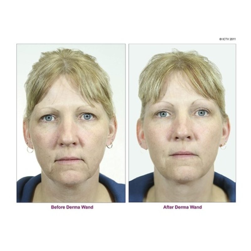 Dermawand Professional Skin Care for Smooth and Youthful Skin in Just 3 Minutes per Day