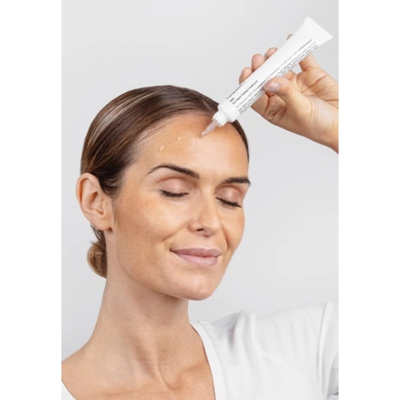 PIH Sun Spot Fading Treatment for Post-Inflammatory Hyperpigmentation