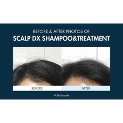 Dr.Ceuracle Scalp DX Scaling Shampoo Hair Loss Care Glossy Hair Milk Protein Propolis Extract Deep Daily Cleansing