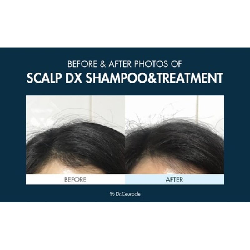 Dr.Ceuracle Scalp DX Scaling Shampoo Hair Loss Care Glossy Hair Milk Protein Propolis Extract Deep Daily Cleansing