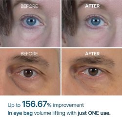 Eyephalt Eyebag Cream for Puffiness, Dark Circles & Fine Lines