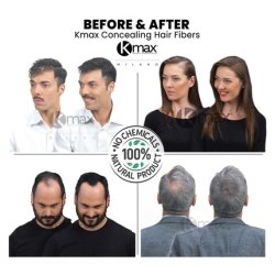 Kmax Concealing Hair Fibers Keratin Fibers Hair Powder for Thickening Effect Hair Fibers for Covering Hair Loss Regular