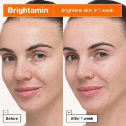Dr.Jart Brightamin Brightening Serum for Visible Fine Lines with Vitamin C