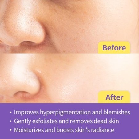 Double Vita Drop in Serum Special Kit