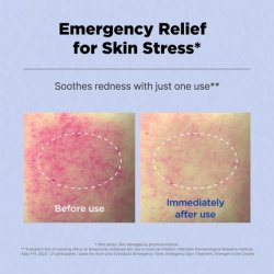 Isoi Acni Dr. 1st Control Tonic Plant-Based Soothing Formula for Oily Skin