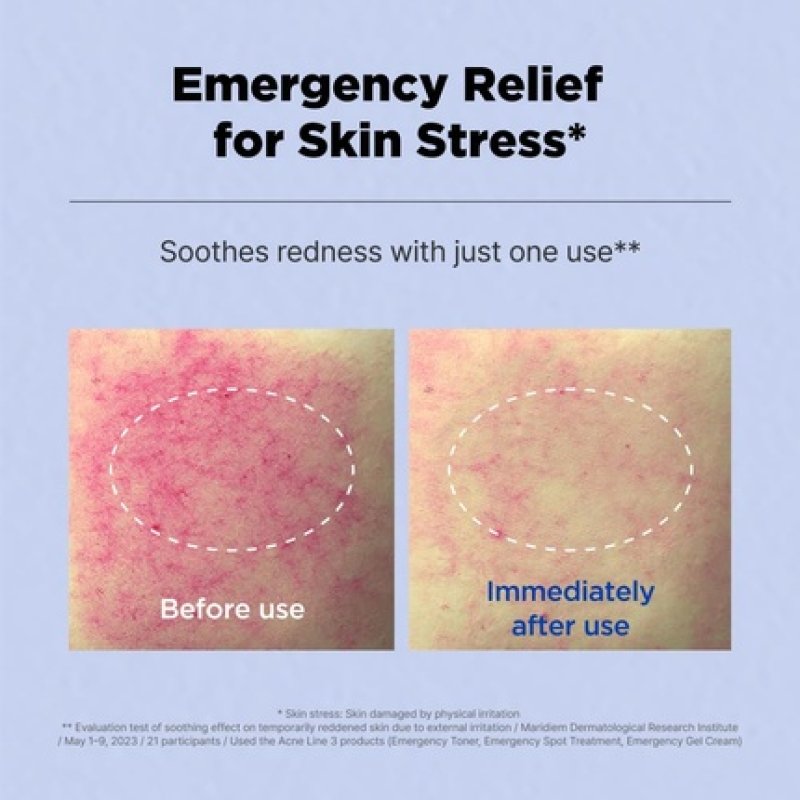 Isoi Acni Dr. 1st Control Tonic Plant-Based Soothing Formula for Oily Skin