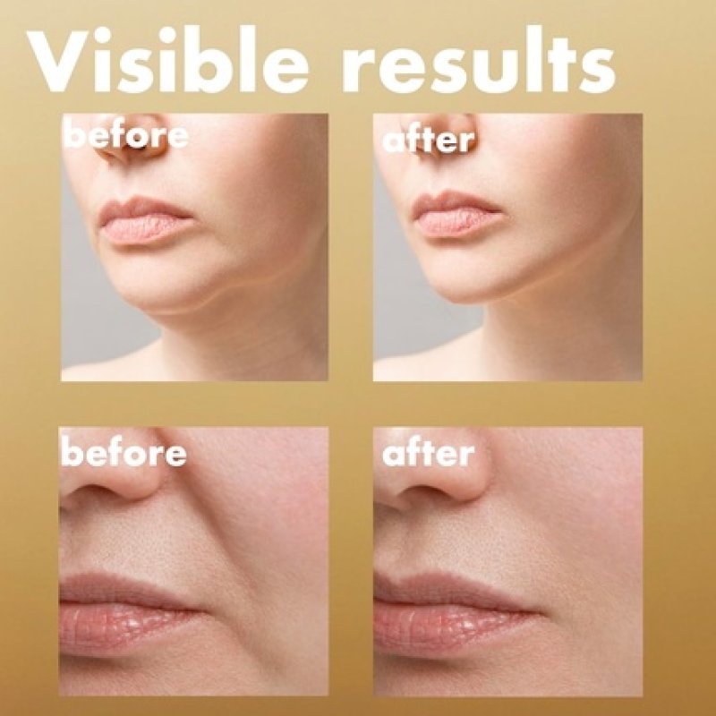 Isoi Intensive Lifting Serum Premium Hydrating Serum for Skin Elasticity