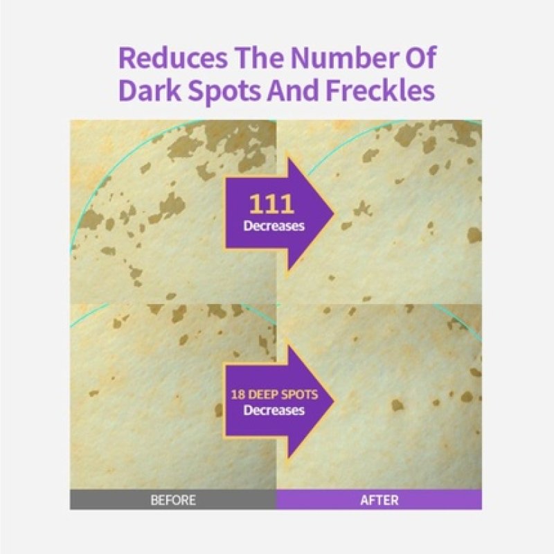 Sungboon Editor Meoru Podo Vita C Turn-Over Ampoule with Niacinamide and Vitamin C