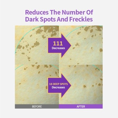 Sungboon Editor Meoru Podo Vita C Turn-Over Ampoule with Niacinamide and Vitamin C