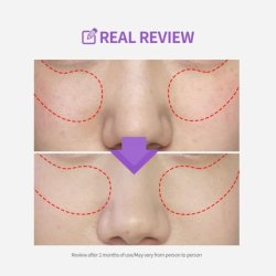 Sungboon Editor Meoru Podo Vita C Turn-Over Pad 60 Sheets with Niacinamide and Vitamin