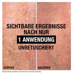 Neutrogena Intense Repair Cica Body Balm Moisturizing