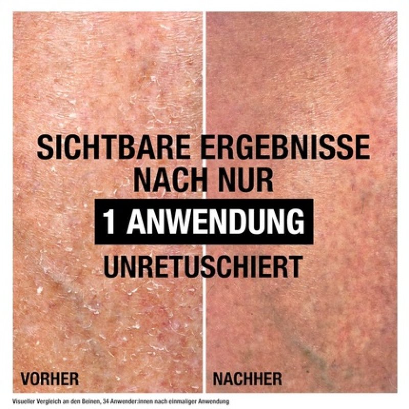 Neutrogena Intense Repair Cica Body Balm Moisturizing