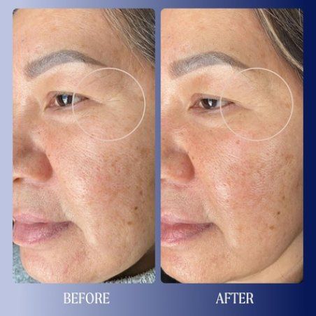 Kinship Dreamwave 2% Bio-Retinoid Overnight Renewal Serum - Retinol