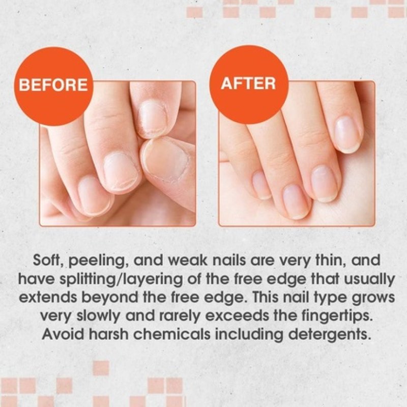 Nail Tek Intensive Therapy for Soft Peeling Nails 15ml