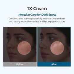 Tx Tranexamic Acid Cream for Skin Freckles and Blemishes