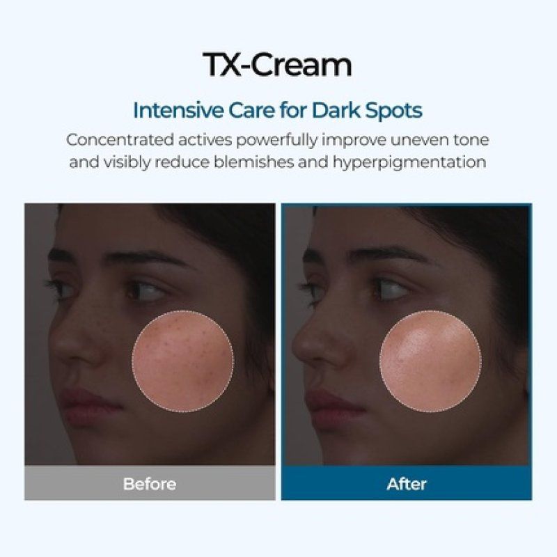 Tx Tranexamic Acid Cream for Skin Freckles and Blemishes