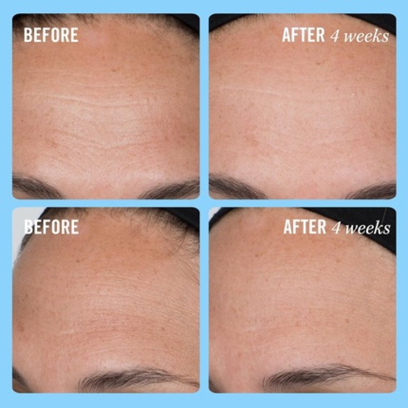 First Aid Beauty Firming Collagen Cream with Collagen, Peptides, and Niacinamide