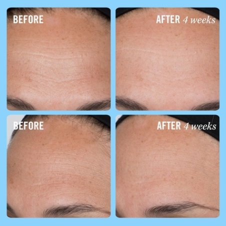 First Aid Beauty Firming Collagen Cream with Collagen, Peptides, and Niacinamide