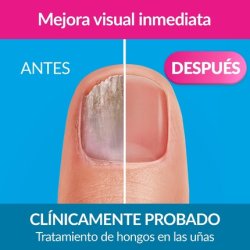 Excilor Nail Fungal Infection Treatment Forte Color Nude