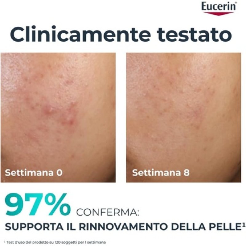 Eucerin Dermopure Clinical Peeling 10 Facial Exfoliating Treatment 40ml