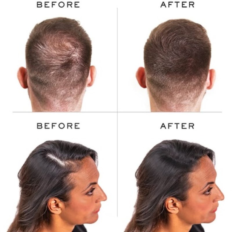 Nanogen Keratin Thickening Hair Fibres 15g Black