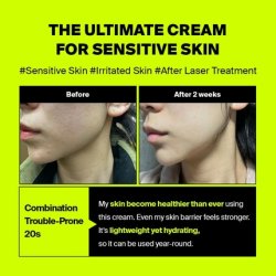 Pixcell Biom After Laser Rebooting Cream for Probiotic Barrier Recovery