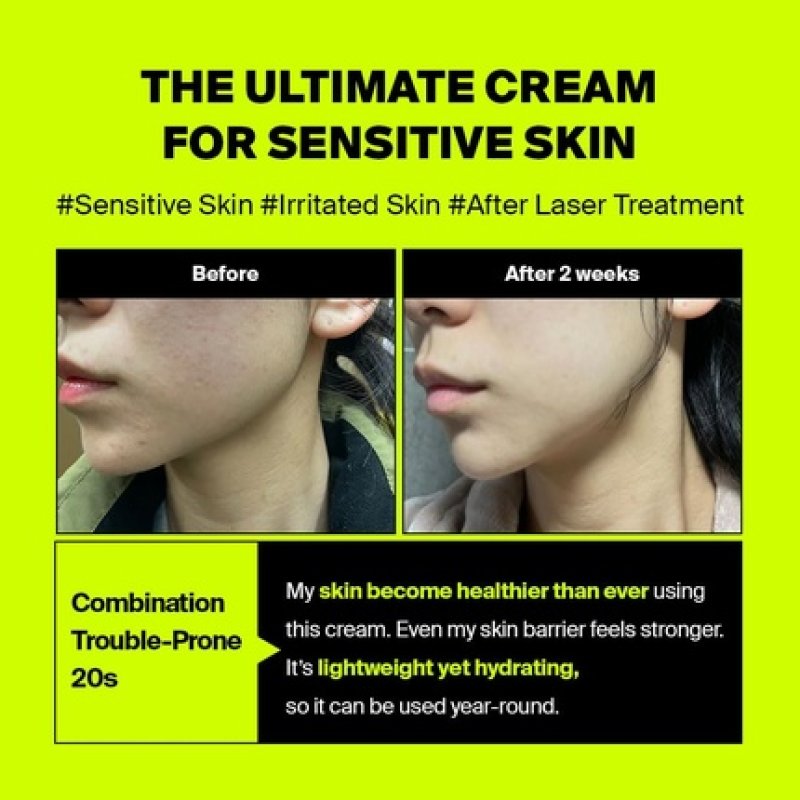 Pixcell Biom After Laser Rebooting Cream for Probiotic Barrier Recovery