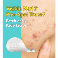 Troubless Micropoint Patch Plus Vitamin C for Dark Spots