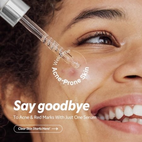 Tirtir Azelaic Acid 12 Serum for Blemish-Prone Skin Lightweight Hydrating