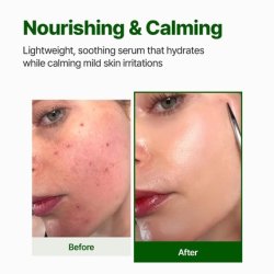 Nacific Cica PDRN Calming Serum 50ml Centella Asiatica Soothing