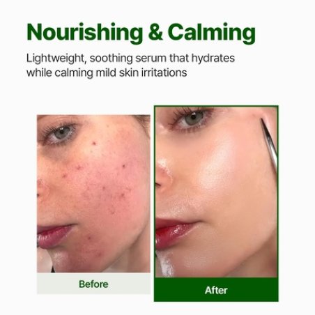 Nacific Cica PDRN Calming Serum 50ml Centella Asiatica Soothing