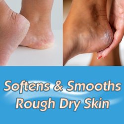 Masterplast Heel Balm 70g