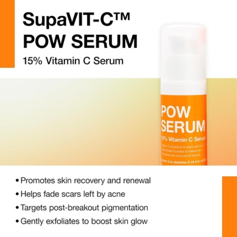 Carbon Theory Vitamin C Serum for Face - Brightening Serum to Boost Skin Glow