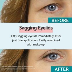 Remescar Sagging Eyelids Instant Treatment Drooping Eyelids Cream 8ml