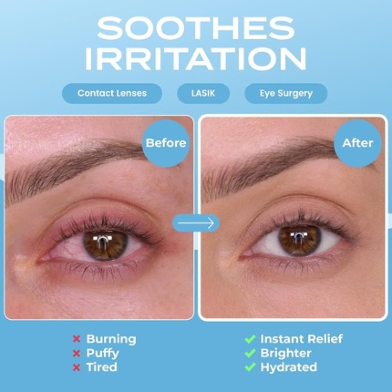 Body Restore Self-Heating Steam Eye Mask - Pack of 5